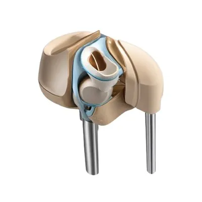 Artritis zamjena koljena